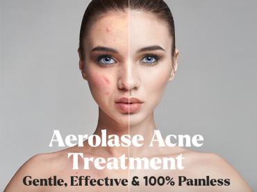 Absolutely Painless, Incredibly Effective Acne Solution is Here