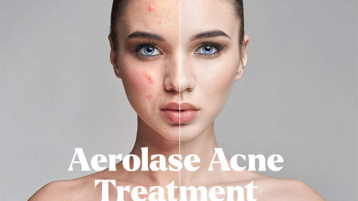 Absolutely Painless, Incredibly Effective Acne Solution is Here