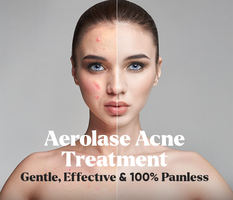 Absolutely Painless, Incredibly Effective Acne Solution is Here